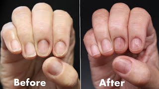 How To Fix DAMAGED THIN amp BRITTLE NAILS NATURAL NAIL STRENGTHENING TREATMENT [upl. by Francine705]