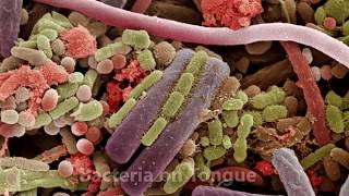 Amazing Things Under Electron Microscope SEM [upl. by Brandi935]