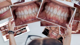 Dental Photography Basics  Standard Views and Photo Series Options for Your DENTAL Practice [upl. by Stanislaus]