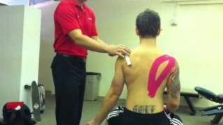 Taping  Supraspinatus facilitation Elastic therapeutic tape [upl. by Harrod]