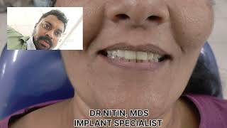 Smile Designing புன்னகை சிரிப் Changing lives by changing Smile  Dr Nitin Samuel MDS [upl. by Earle809]