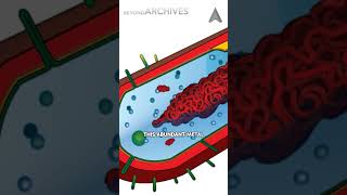 The metal eating bacteria [upl. by Isbel]