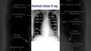 How to read X rays in40 secondsStep wise xrayradiologyhowtoreadstepbystep themagicalwaytolearn [upl. by Stovall]