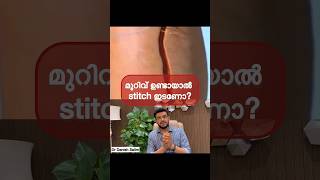 മുറിവ് ഉണ്ടായാൽ സ്റ്റിച്ച് ഇടുമ്പോൾ എന്താണ് സംഭവിക്കുന്നത് Wound treatment [upl. by Eciryt713]