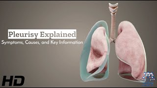 Pleurisy Unveiled Understanding Symptoms Causes and Vital Information [upl. by Ydennek]