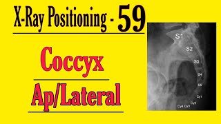 Coccyx APLateral Projection Hindi  X Ray Positioning for Radiographers  Doctor Inside Academy [upl. by Hgielhsa]