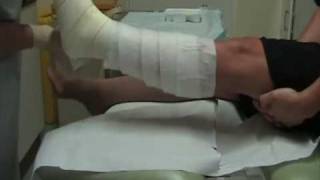 Wound Management  How to apply a single layer high compression bandage [upl. by Missak]