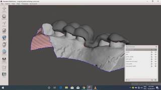 Meshmixer dental implant surgical guide [upl. by Alexandre983]