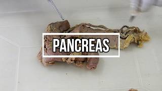 Pancreas  gross anatomy [upl. by Clercq]