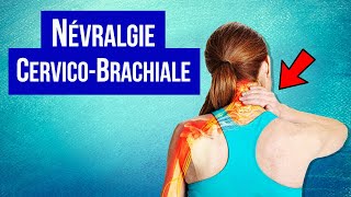 Névralgie cervicobrachiale  Symptôme et Traitement [upl. by Gun]