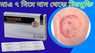 দাদ হলে কি করবেন  দাদের চিকিৎসা  Terbikil 250  Dermomix Cream  Fungal infection  Ringwarm [upl. by Iba366]