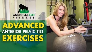 Anterior Pelvic Tilt Correction  3 ADVANCED Strengthening Exercises [upl. by Eecyak]