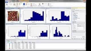 How to Detect and Analyze Particles in Images [upl. by Malin]