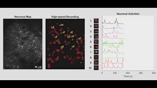 InVivo Imaging of the Neuronal Activity in Mouse Primary Visual Cortex [upl. by Thibault134]