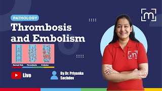 Thrombosis and Embolism with Dr Priyanka Sachdev [upl. by Cynthea]