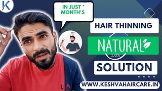 Control quot Hair Thinningquot In 2 Months ✅ All Naturally 🔥 keshvahaircare [upl. by Jeana590]