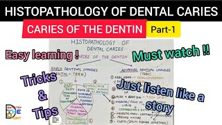 HISTOPATHOLOGY OF DENTAL CARIES  CARIES OF THE DENTIN PART1 [upl. by Kcirred]