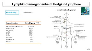 Lymphknotenregionen beim Hodgkin Lymphom  Strahlentherapie Prof Hilke Vorwerk [upl. by Waldman]