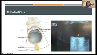 Neurocritical Care amp Pearls Noninvasive Monitoring of Intracranial Pressure Alexandra Reynolds MD [upl. by Gnirps950]