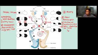 Lesions of the Visual Pathway [upl. by Rudyard]