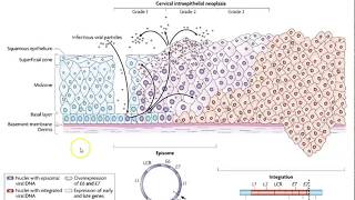 Molecular Diagnostics Hybrid capture and HPV detection [upl. by Dreher]