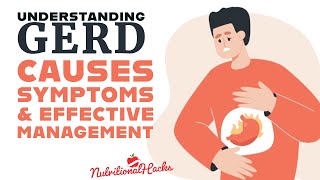 Understanding GERD Causes Symptoms and Effective Management [upl. by Tiphani307]