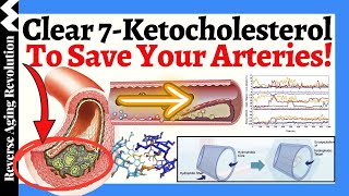 Clear 7Ketocholesterol To SAVE Your Arteries A NOVEL Approach To Heart Health [upl. by Stutman]