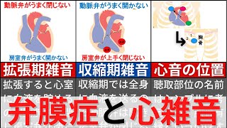 【11分で解説、10分で国試問題】弁膜症について解説 [upl. by Hcelemile509]