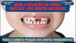 Como a dentição mista passa pela troca dos dentes Aula 62 [upl. by Colburn]