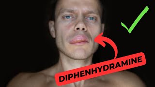 The Benefits and Risks of Diphenhydramine A Comprehensive Guide [upl. by Clemens]