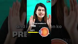 Cataract and Presbyopia Explained in 40 Seconds shorts class10th class10thscience [upl. by Odilo]