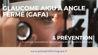 Glaucome aigu à angle fermé et sa prévention par iridotomie laser Pole ophtalmologique [upl. by Naihtsirc]