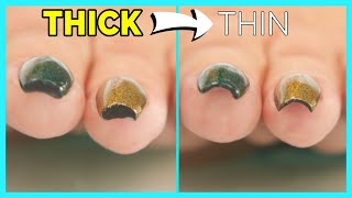 Thick Ugly Nails QUICK HACK To Thin [upl. by Urd227]