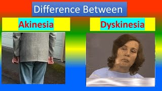 Difference between Akinesia and Dyskinesia [upl. by Atival]