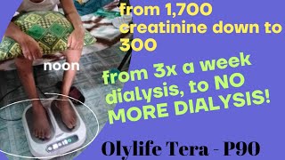 Dialysis 3x a week to STOP DIALYSIS Tera P90 Machine [upl. by Aisila]