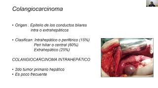tumores hepáticos malignos [upl. by Gnilrets]