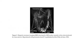 Colonic transit study [upl. by Kassity]