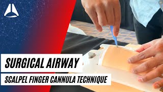 Scalpel Finger Cannula technique in CICO emergencies  Airway Management [upl. by Reifnnej523]