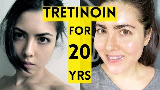 20 Year Results of Using Tretinoin [upl. by Duky]