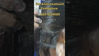 how to remove nits and lice hair nits nitsremoval lice peenu eerulice removal treatment [upl. by Benkley]