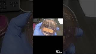 Escherichia coli E coli on MacConkey agar MAC  Clinical Microbiology shorts [upl. by Mojgan963]