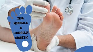 Diabetul Zaharat 10 Sfaturi ca sa NU Ajungi la Amputatie [upl. by Aurilia]