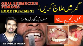 Best Medicine for Oral Submucous Fibrosis  Home Treatment  InqalabFareed [upl. by Eelydnarb799]