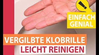 Vergilbte Klobrille leicht reinigen Toilettensitz von gelb nach weiß [upl. by Nole]