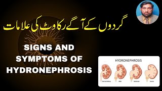 What are the signs amp sypmtoms of hydronephrosisPresentation [upl. by Robb342]