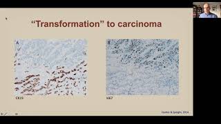 Odontogenic Cysts and Tumours diagnostic challenges Part 8 [upl. by Ettenad480]