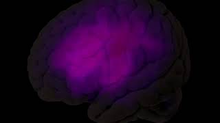 Anatomical Tracings of Lesions After Stroke [upl. by Eimaraj]