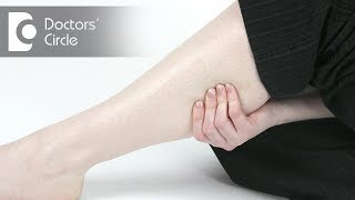 What can cause continuous muscle twitching of limbs after exercise  Dr Mohan M R [upl. by Daza741]