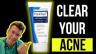 Doctor explains how to use BENZOYL PEROXIDE for ACNE aka PanOxyl  Acnecide  Side effects amp more [upl. by Nnairrek898]