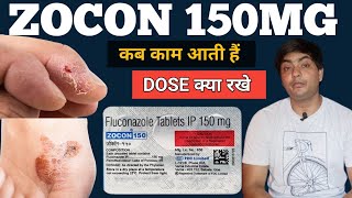 zocon 150  zocon 150 is used for in hindi  zocon 150 tablet  zocon 150 fluconazole [upl. by Airotahs]